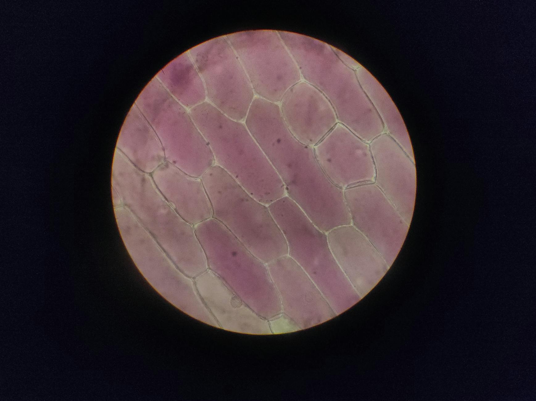 Cellular Complexity: A Leap Forward with Double Cells