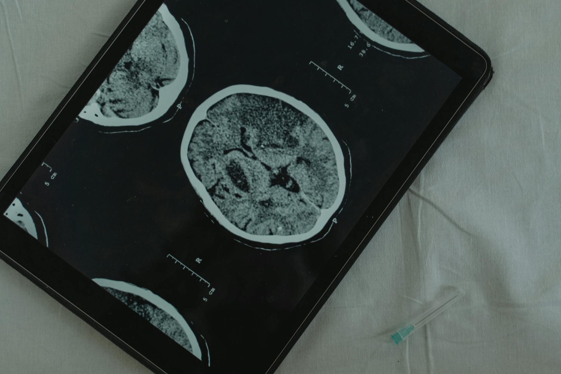 Case Law Lags Behind Scientific Research on Juvenile Brain Function